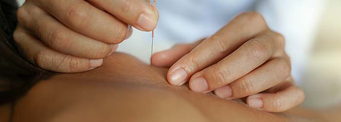 Chronic Muscle Pain